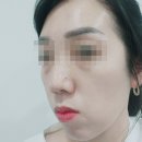 30대화장품 기초화장품 앰플세럼 미스트 아르베라 리페어랩 패키지