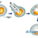 백혈병 [白血病, leukemia] 이미지