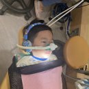 웃음치료 | 4살 아이 충치 치료 후기 웃음가스 효과