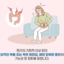 다양한 잔변감 원인 해결 방법 이미지