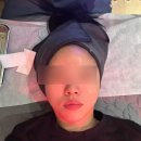 원자한의원 | 강남역 한의원 피부 모공 관리 내돈내산 후기 통증 가격 캐비어 리빌더