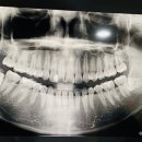 이튼튼구강악안면외과치과의원 이미지