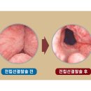 고려리프트 이미지