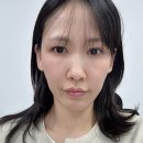 클래시 | 청담피부과 콜라겐 부스터 디클래시 CaHA 만족 후기