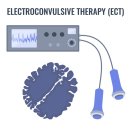 난치성 우울증 환자의 전기경련치료(Electroconvulsive Therapy, ECT) 원리와 기전 이미지