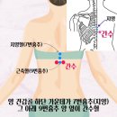 자연치유쑥뜸