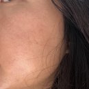 티에스(TS) | TS 에멀전 민감성로션 수부지로션 리스킨 솔직 사용 후기