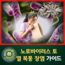 노로바이러스 토 열 복통 장염 주의