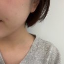 CU서면금강점 | 부산 서면 윤곽주사 내돈 후기(비포&amp;애프터 있음)