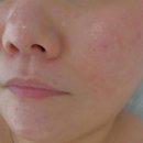 블랑드보떼 | 화성 남양 피부관리 [ 블랑드보떼 ] #남양에스테틱