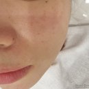 샤론타운화장품 - 관악구 신사로14길 46 | 화성 남양 '샤론뷰티에스테틱' 세멘시트팩 파이토신 관리 후기, 문제성피부관리 여드름케어