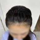 촘촘 스칼프 이미지