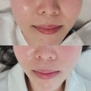 o.o.t.d | [공지] [추석이벤트] 구의동 피부관리 10월 이벤트 - 환절기 피부는 블랑드제이 에스테틱에서