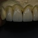 에나멜 치과기공소 이미지