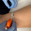 4734 | 운남동 에스테틱 애끌로 팔뚝관리 후기｜웨이브온리프팅+고주파 효과 리얼후기