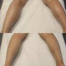 평택 동삭동 피부관리 부종 빼는 하체관리 추천 앨빈스킨케어 솔직후기