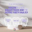 스타교정치과기공소 이미지