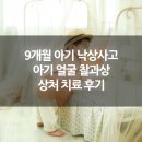 9개월 아기 낙상사고 얼굴 찰과상 상처 치료 후기