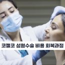 코젤코 성형수술 부작용 회복과정 비용 총청리