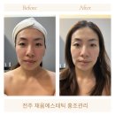 큐사랑채움에스테틱 | [전주 효자동 피부관리] 채움에스테틱에서 맞춤형 홍조관리 받은 후기
