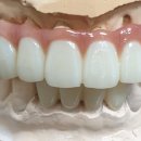 지안치과기공소 이미지