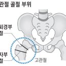 ♧ 고관절 골절 72시간 내 수술해야 사망률 낮춘다 ♧ 이미지