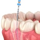 탑티어치과의원 이미지