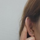 귀 켈로이드 주사 후기 /피어싱 켈로이드 주사 제거 (내돈내산)