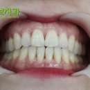허브치과 이미지