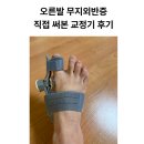 조이랩스 | 오른발 무지외반증 때문에 직접 써본 이그랩스 교정기 후기, 나는 밤에 착용하는 쪽이 더 잘 맞았다.