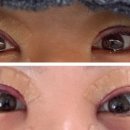 아이컨텍성형외과의원 이미지