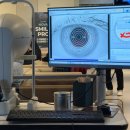 웰아이안경 | 눈 충혈 원인 왜 자꾸 반복될까? 해결 방법 꿀팁 포함