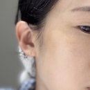 25-C | 아이오페 비타민C 엑스퍼트 25% 항산화 토닝앰플 후기 효과 단점