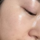 다지워 | 50대 흑자 집에서 홈케어해서 지워진 내돈내산 후기