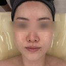 브이브이아이피(VVIP) 에스테틱 | 피부관리 광교 얼굴 경락 얼굴축소와 브이라인 리프팅까지 한 번에! 엘트리움스킨앤바디 수원 광교점 후기
