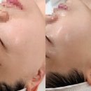 정든 | 익산 피부관리 추천 정든에스테틱 물방울 관리 후기