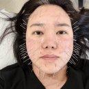 삼성전기(주) 부속의원 | 보람동50대피부탄력 관리, 인위적인 시술 대신 ‘정안침’을 선택하는 이유