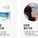 은계스마트치과의원 | 시흥은계치과, 턱이 뻐근하고 소리가 난다면?