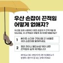 우산손잡이 끈적거림 이미지