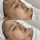 신창메디칼 | 광주 수완지구 피부관리 웨딩준비는 [드에르] 내돈내산 추천