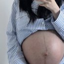 빛과소금약국 | 곽생로 산부인과 송도점 제왕절개 출산 , 4박5일 입원 후기