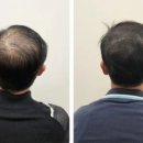 고은하늘성형외과 네이버블로그