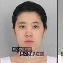 렛미인피부 이미지