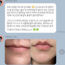 로미스핏