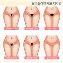 나주겨드랑이 브라질리언 제모 추천 여의사니까 민망한 부위도 편하게 이미지