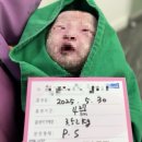 드디어 출산일/ 예일산부인과 제왕절개 후기 1일차