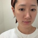 슬림피트니스 | 엔진리프팅 한남동피부과 에서 페이스 피트니스 동안리프팅 리얼후기!