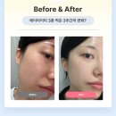 글리밍플라워 이미지