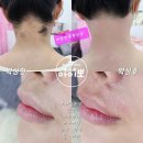 아이뽀네일