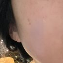EFG진정크림 메타포레 4GF 레스큐 크림 후기